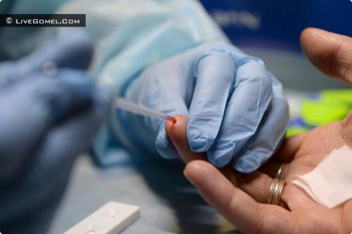 Заболеваемость ВИЧ-инфекцией В Гомельской области в прошлом году дала прирост на 1,5%